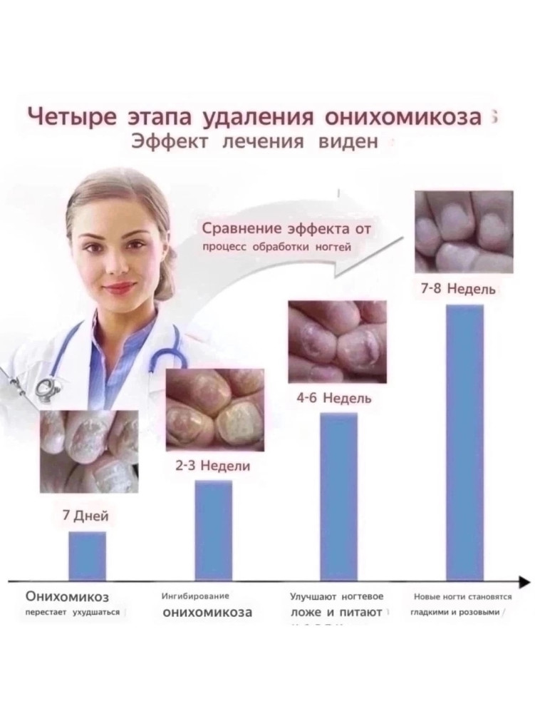 Купить Противогрибковые средства для ногтей оптом Садовод Интернет-каталог Садовод интернет-каталог